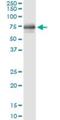 HCK Proto-Oncogene, Src Family Tyrosine Kinase antibody, H00003055-M01, Novus Biologicals, Immunoprecipitation image 