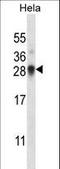 Small nuclear ribonucleoprotein-associated protein N antibody, LS-C161359, Lifespan Biosciences, Western Blot image 