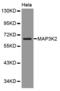 Mitogen-Activated Protein Kinase Kinase Kinase 2 antibody, MBS126851, MyBioSource, Western Blot image 