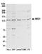 Nardilysin Convertase antibody, A304-961A, Bethyl Labs, Western Blot image 