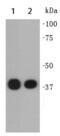 Actin Alpha 2, Smooth Muscle antibody, TA323891, Origene, Western Blot image 