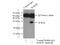 RAB20, Member RAS Oncogene Family antibody, 11616-1-AP, Proteintech Group, Immunoprecipitation image 