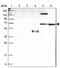 Coenzyme A Synthase antibody, NBP1-84989, Novus Biologicals, Western Blot image 