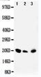 Dual Specificity Phosphatase 3 antibody, PA5-79174, Invitrogen Antibodies, Western Blot image 
