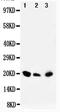 Dual Specificity Phosphatase 3 antibody, PA5-79174, Invitrogen Antibodies, Western Blot image 