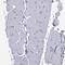 Cadherin Related Family Member 3 antibody, PA5-52805, Invitrogen Antibodies, Immunohistochemistry paraffin image 