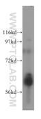 Aladin WD Repeat Nucleoporin antibody, 15127-1-AP, Proteintech Group, Western Blot image 