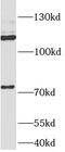 Amyloid Beta Precursor Like Protein 2 antibody, FNab00487, FineTest, Western Blot image 