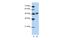 WD Repeat Domain 13 antibody, A13007, Boster Biological Technology, Western Blot image 