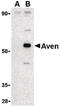 Apoptosis And Caspase Activation Inhibitor antibody, LS-B444, Lifespan Biosciences, Western Blot image 