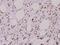 AKT Serine/Threonine Kinase 2 antibody, A00725S474, Boster Biological Technology, Immunohistochemistry frozen image 