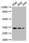 Murein tetrapeptide carboxypeptidase antibody, orb240609, Biorbyt, Western Blot image 