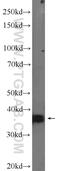 SIX Homeobox 2 antibody, 11562-1-AP, Proteintech Group, Western Blot image 