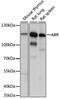 ABR Activator Of RhoGEF And GTPase antibody, 16-153, ProSci, Western Blot image 