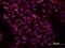 VANGL Planar Cell Polarity Protein 1 antibody, MAB5476, R&D Systems, Immunocytochemistry image 