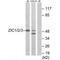 Zic Family Member 1 antibody, A05537, Boster Biological Technology, Western Blot image 