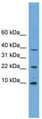 Cytochrome C Oxidase Assembly Factor 4 Homolog antibody, TA345008, Origene, Western Blot image 