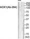 ACK1 antibody, TA315029, Origene, Western Blot image 