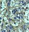 Heparanase antibody, orb77858, Biorbyt, Immunohistochemistry paraffin image 