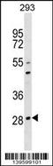 Osteoclast Associated Ig-Like Receptor antibody, 60-164, ProSci, Western Blot image 