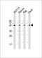 Fc Receptor Like 4 antibody, 64-144, ProSci, Western Blot image 