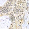 Proteasome 26S Subunit, ATPase 5 antibody, A1538, ABclonal Technology, Immunohistochemistry paraffin image 