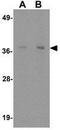 LMTD1 antibody, GTX31450, GeneTex, Western Blot image 