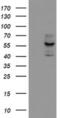 Cytochrome P450 Family 17 Subfamily A Member 1 antibody, MA5-25673, Invitrogen Antibodies, Western Blot image 