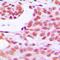 Homeobox D12 antibody, orb214055, Biorbyt, Immunohistochemistry paraffin image 