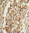 MCL1 Apoptosis Regulator, BCL2 Family Member antibody, A00712-1, Boster Biological Technology, Immunohistochemistry paraffin image 