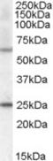 Collagen Type IV Alpha 3 Binding Protein antibody, TA303299, Origene, Western Blot image 