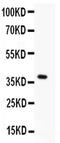 Menin 1 antibody, PA5-79663, Invitrogen Antibodies, Western Blot image 