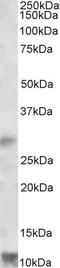 Rbx2 antibody, EB09769, Everest Biotech, Western Blot image 