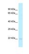 TRNA Splicing Endonuclease Subunit 15 antibody, orb325748, Biorbyt, Western Blot image 