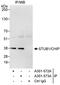STIP1 Homology And U-Box Containing Protein 1 antibody, A301-573A, Bethyl Labs, Chromatin Immunoprecipitation image 