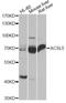 Long-chain-fatty-acid--CoA ligase 5 antibody, A14130, ABclonal Technology, Western Blot image 