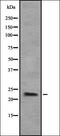 COP9 Signalosome Subunit 8 antibody, orb337126, Biorbyt, Western Blot image 