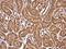 eIF4E antibody, GTX132092, GeneTex, Immunohistochemistry paraffin image 