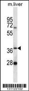 PNKD Metallo-Beta-Lactamase Domain Containing antibody, 56-510, ProSci, Western Blot image 