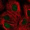 Deoxycytidine Kinase antibody, HPA059609, Atlas Antibodies, Immunofluorescence image 