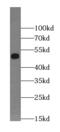 Potassium Voltage-Gated Channel Subfamily J Member 8 antibody, FNab04587, FineTest, Western Blot image 