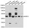 NHL Repeat Containing E3 Ubiquitin Protein Ligase 1 antibody, A6669, ABclonal Technology, Western Blot image 