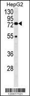 Hexosaminidase Subunit Alpha antibody, MBS9203867, MyBioSource, Western Blot image 