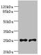 Triggering Receptor Expressed On Myeloid Cells 2 antibody, A61478-100, Epigentek, Western Blot image 
