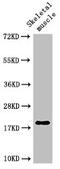 Troponin C1, Slow Skeletal And Cardiac Type antibody, CSB-PA024009LA01HU, Cusabio, Western Blot image 