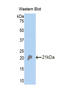 Complement Factor Properdin antibody, LS-C300284, Lifespan Biosciences, Western Blot image 