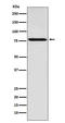 Coilin antibody, M02784, Boster Biological Technology, Western Blot image 