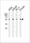 Adrenoceptor Alpha 1D antibody, PA5-72171, Invitrogen Antibodies, Western Blot image 
