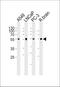 Adrenoceptor Alpha 1D antibody, PA5-72171, Invitrogen Antibodies, Western Blot image 