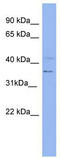 Keratin 13 antibody, TA346320, Origene, Western Blot image 